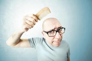 ŁYSIENIE u mężczyzn - przyczyny i leczenie wypadania włosów