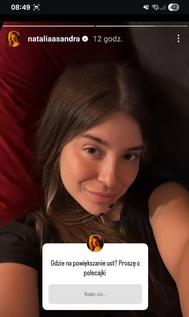 Natalia Zambrzycka (Agata z serialu Barwy szczęścia) powiększa sobie usta od lat