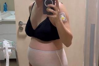 Lil Masti pokazała, jak wygląda jej ciało tuż po cesarce. Mocne zdjęcia bez żadnej ściemy! 