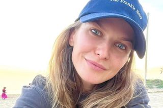 Anna Lewandowska walczy z przykrą przypadłością. Spuchnięta buzia, spuchnięte oczy