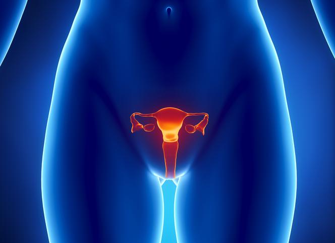 Jądrzak – nowotwór jajnika – prowadzi do pojawienia się męskich cech u kobiety