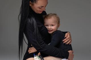 Córeczka policjantów cierpi każdego dnia. Potrzebna kosztowna operacja [ZDJĘCIA]