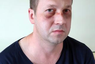 Skatował go naćpany pacjent