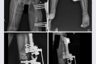 Córeczka policjantów cierpi każdego dnia. Potrzebna kosztowna operacja [ZDJĘCIA]