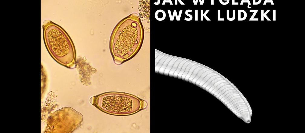 Jak wygląda owsik ludzki?