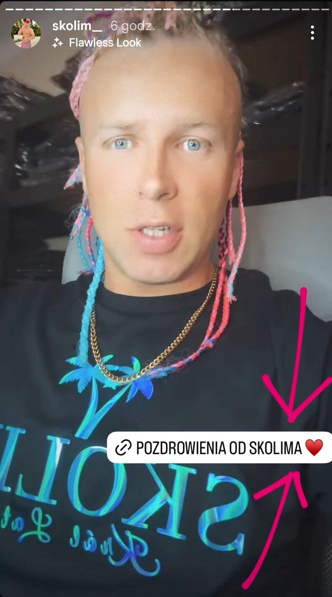 Skolim zaszalał z fryzurą. Ale metamorfoza!