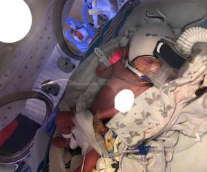 Apel o pomoc dla bliźniaków