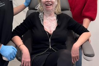 Mariola Bojarska-Ferenc kłuje się dla urody