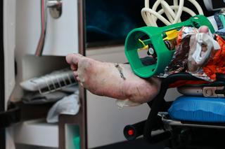 Spłonął przywiązany do łóżka? Potworna śmierć pacjenta szpitala w Częstochowie