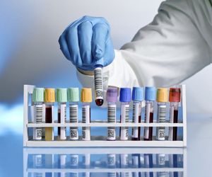 Ciała ketonowe w moczu