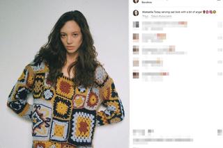 Koszmarny wypadek pięknej modelki. Jej twarz i ręce niemal spłonęły. Wieniawa apeluje o pomoc