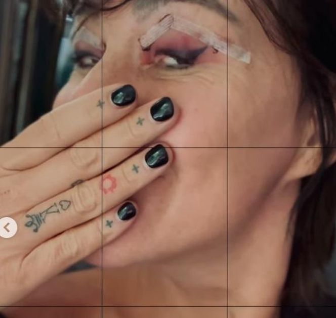 Katarzyna Skowrońska przeszła operację plastyczną