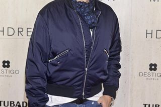 Krzysztof Gojdź zafundował sobie lifting twarzy. Zabieg jest bezbolesny