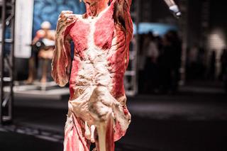 Bodies Revealed