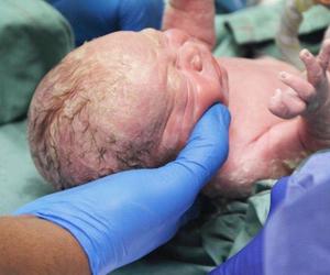 Operacja to nie narodziny. Fotograf porodowy odmówił zrobienia zdjęć i rozpętał burzę