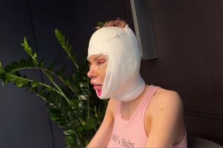 Julia Von Stein po operacji 