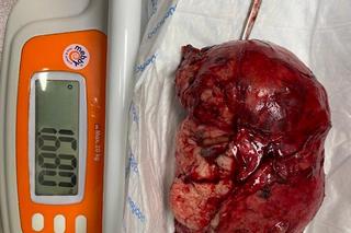 Weterynarze wycięli Zuzi gigantycznego guza