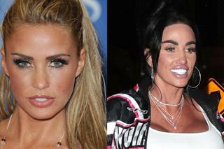 Katie Price kiedyś i dziś. Na zdjęciach z lat 90. wygląda zupełnie inaczej! Tak zmieniły ją operacje plastyczne