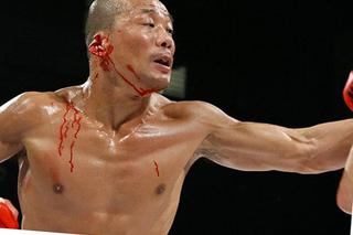 SZOK! Drastyczne zdjęcia. Zawodnik MMA - Shigeyuki Uchiyama stracił kawałek ucha w walce
