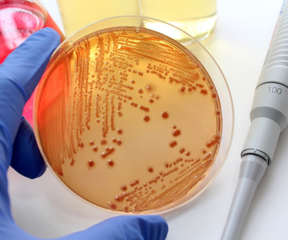 OXA-48 to groźny typ bakterii - jak można się nią zarazić?