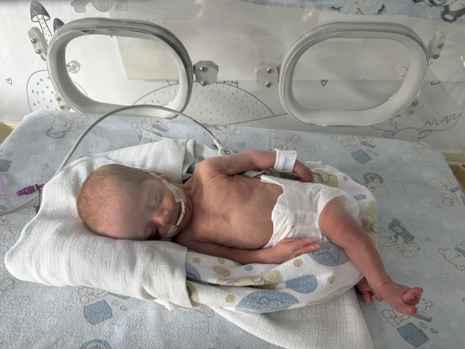 Niezwykłe narodziny w szpitalu w Rzeszowie. Na świat przyszły trojaczki!