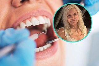 Dentystka Anita z „Sanatorium miłości” krytykuje modę na licówki z Turcji. Utrata zębów za hollywoodzki uśmiech