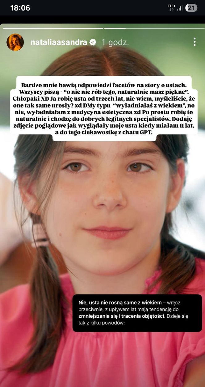 Natalia Zambrzycka (Agata z serialu Barwy szczęścia) powiększa sobie usta od lat. Tak wyglądała jako 11-latka