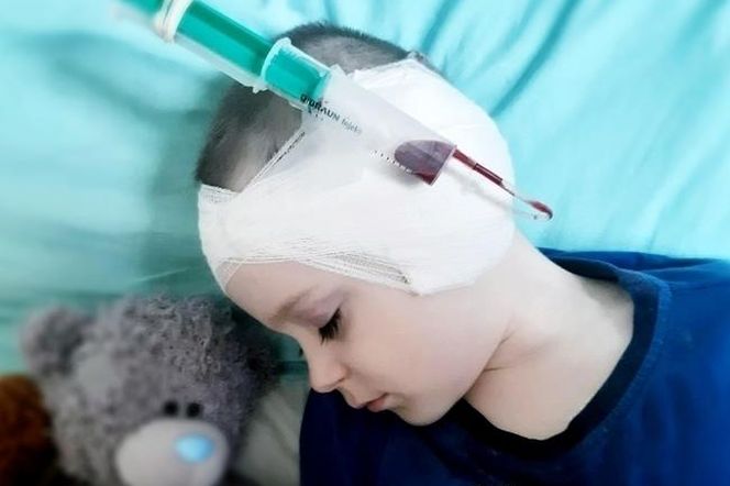 Mały Miłosz stracił słuch po ciężkiej chorobie. I Ty możesz mu pomóc!