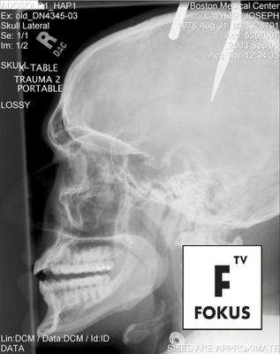 Fokus TV