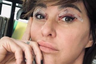 Katarzyna Skowrońska przeszła operację plastyczną