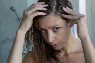 Masz dość przetłuszczających się włosów? 4 złote rady, o których warto pamiętać