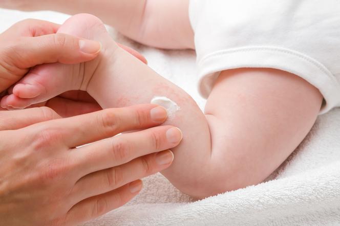 AZS u niemowląt karmionych piersią - skąd się bierze i jak je leczyć?