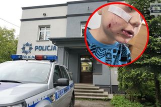 Właścicielowi psa, który pogryzł dziecko grozi nawet więzienie