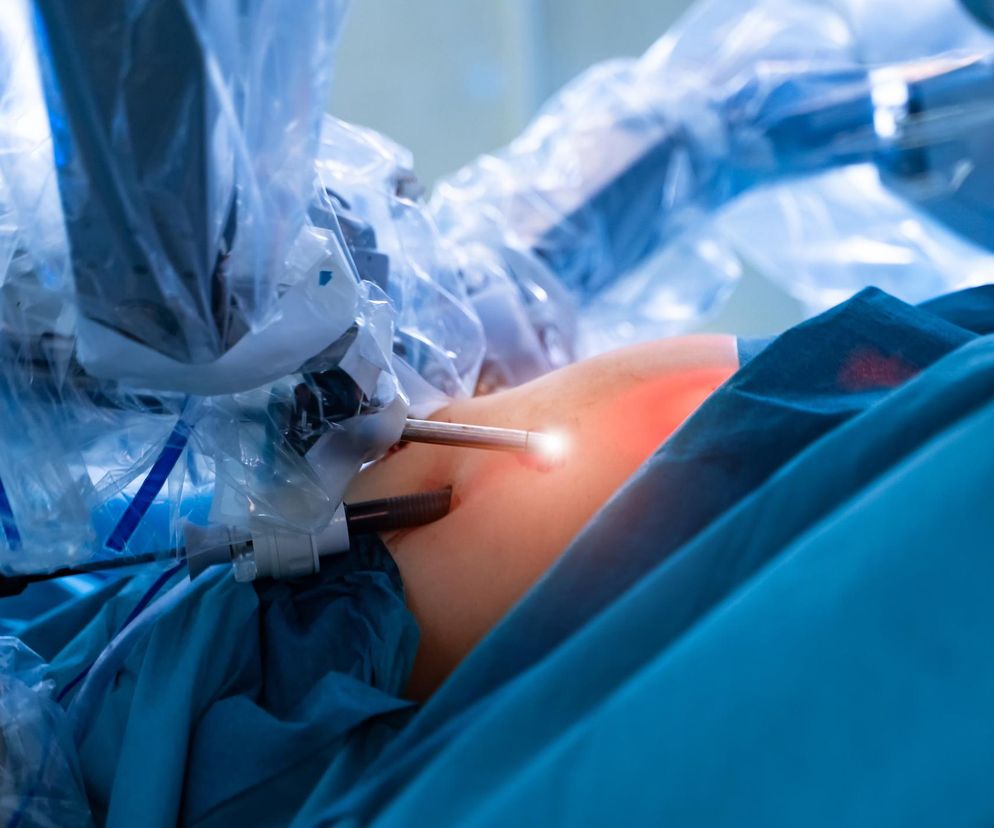 Ten krakowski szpital już operuje za pomocą robota da Vinci. Jakie zabiegi na NFZ?