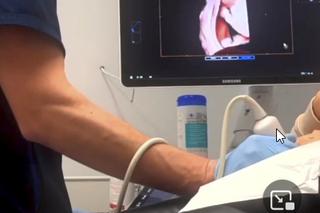 Tak z bliska wygląda twarz Wersow tuż po urodzeniu dziecka. Konsekwencje widać jak na dłoni