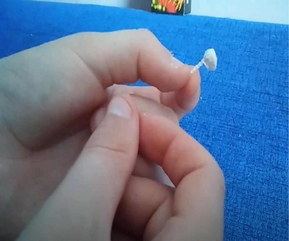 ​11-latek połknął diabełki. Namówili go koledzy w ramach tzw. challengu