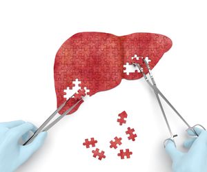 Przeszczep (transplantacja) wątroby - wskazania, czas oczekiwania i rokowania
