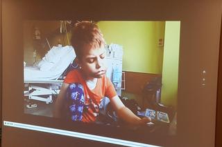 Gliwiccy lekarze dokonali kolejnego na światową skalę przeszczepu narządów szyi