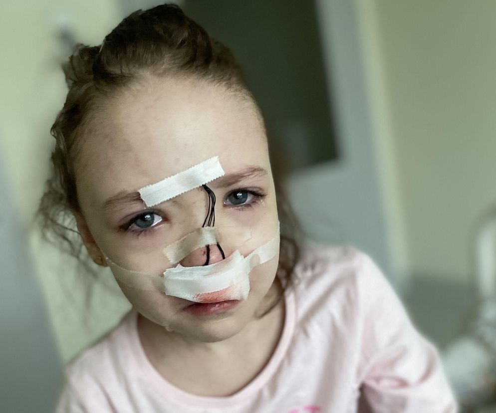 Podziękuję za opieszałość i zaproszę na pogrzeb