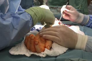 PIERWSZY TEGO TYPU PRZESZCZEP.