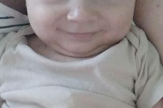 Mały Antoś walczy z guzem mózgu, potrzebuje wsparcia