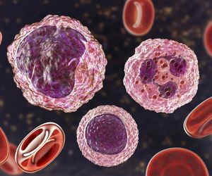 Limfocytoza - o czym świadczy zbyt wysoki poziom limfocytów?