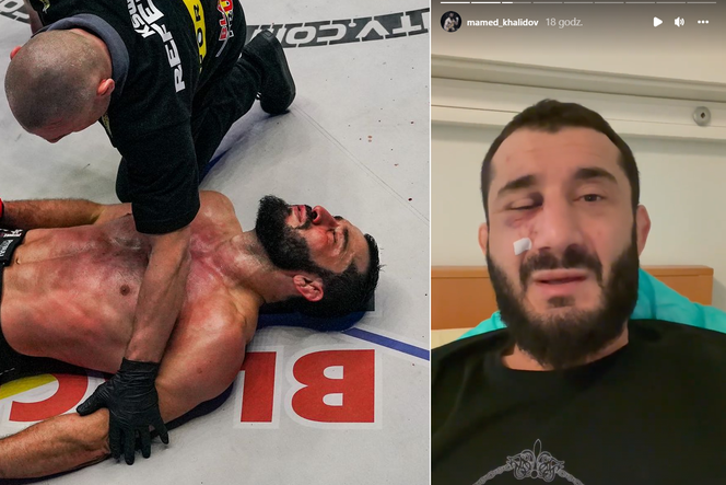 Mamed Khalidov czeka na operację