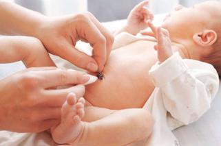 Jak pielęgnować pępek noworodka? Położna radzi