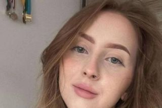 Studenci i pracownicy UKW proszą o pomoc dla Viktorii. Lekarze wycięli dużą część jej kręgosłupa, by mogła żyć