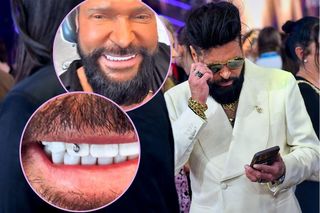 Krzysztof Rutkowski sprawił sobie nowy uśmiech! Teraz dosłownie świeci dolarami! 