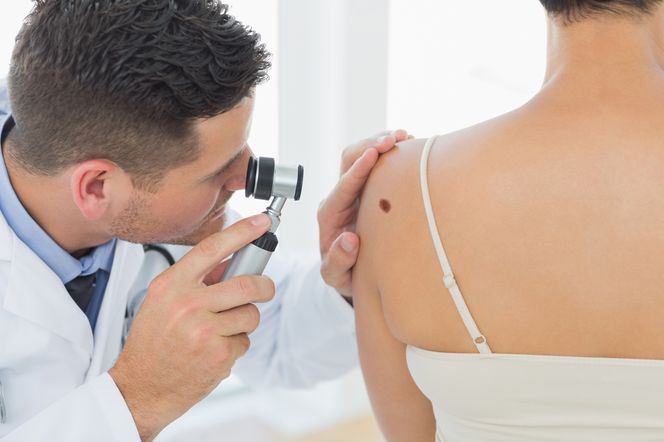 Dermatolog - czym się zajmuje? Choroby i metody leczenia w dermatologii