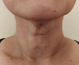 Naszyjnik Wenus może wpędzić a kompleksy. Winne codzienne nawyki