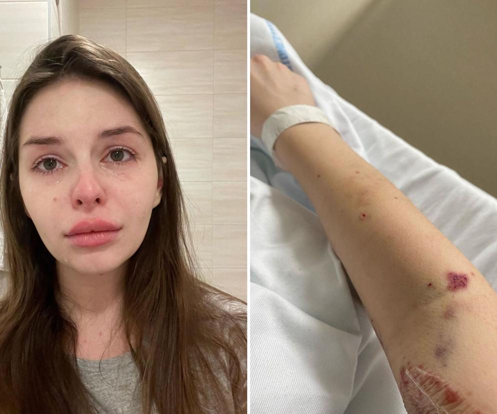 25-latka pokonała guza mózgu, teraz walczy z tajemniczą chorobą. Już 3 miesiąc cierpię