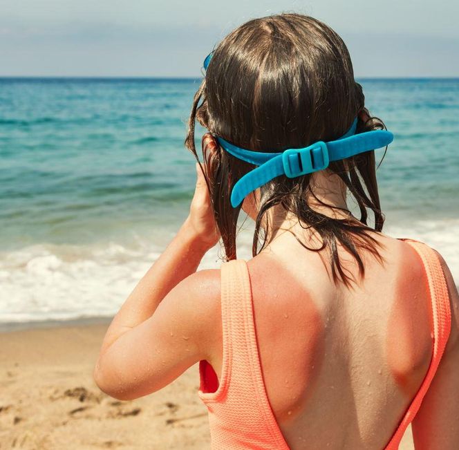 Oparzenie? Słońce, żelazko, grill... Ten jeden spray działa kompleksowo